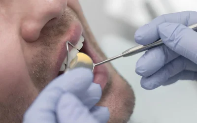 Tratamientos de periodoncia